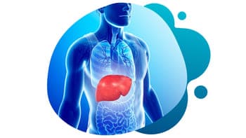 An illustration of non alcoholic fatty liver disease NASH