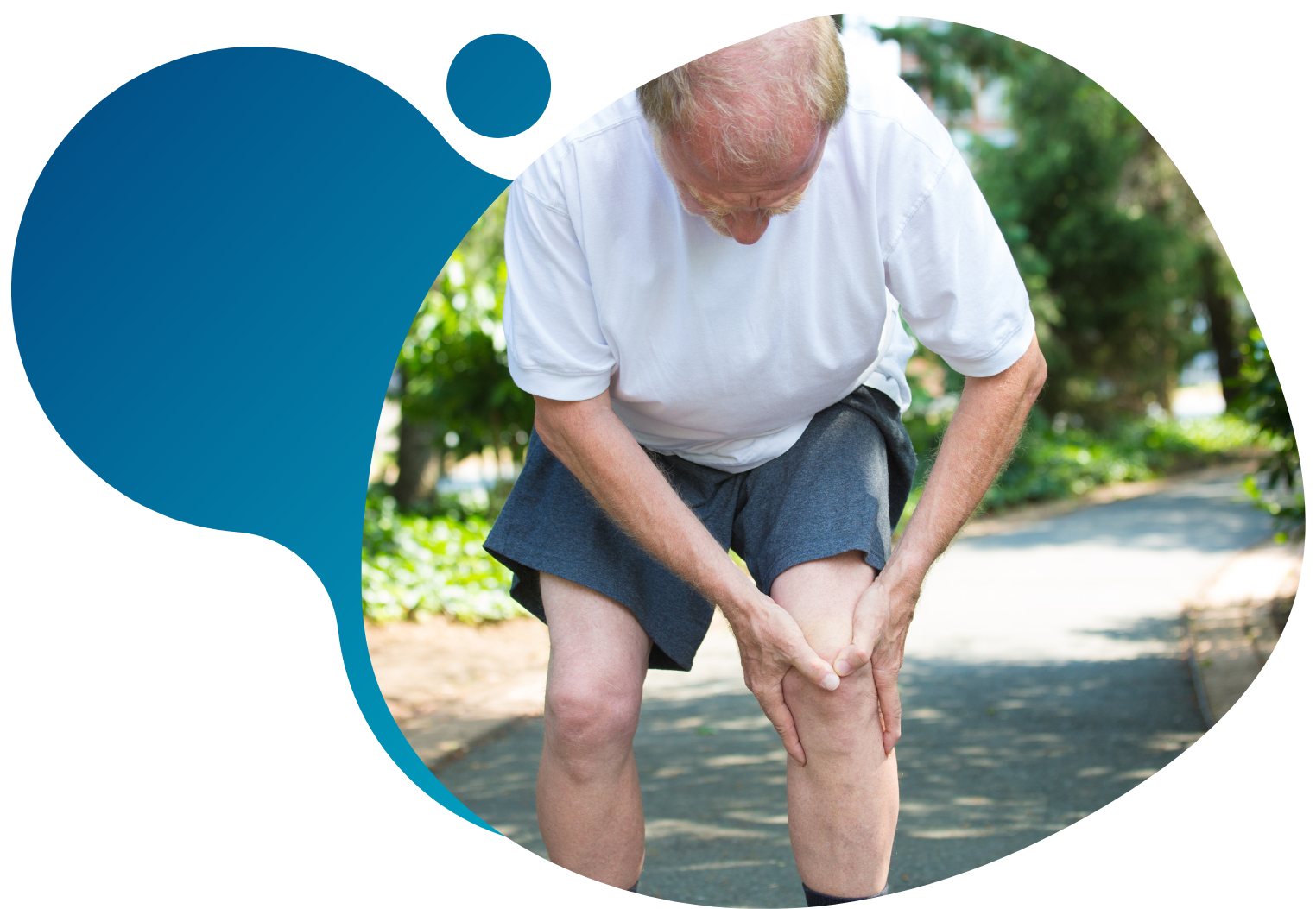 Knee Osteoarthritis