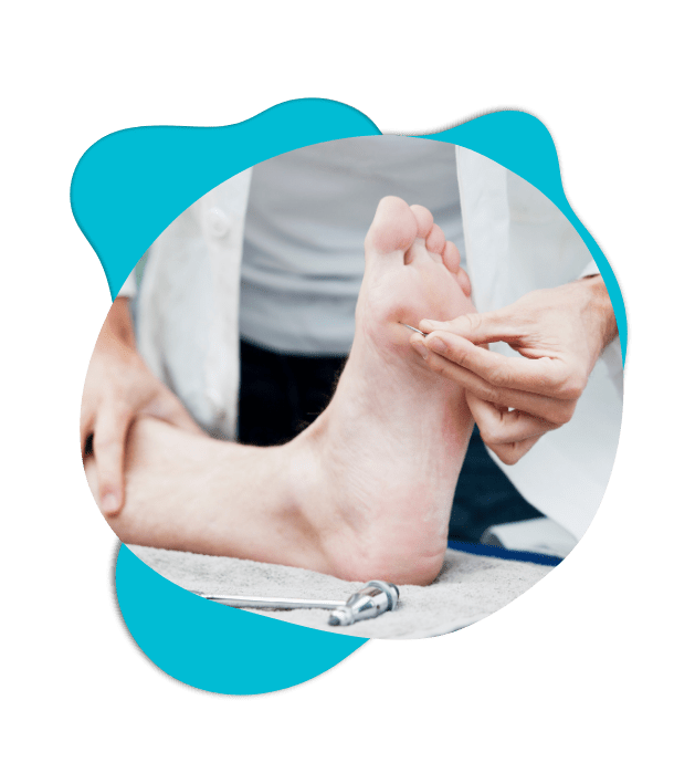 CIPN Website Element (580 x 602 px) (3) Doctor examining foot during clinical assessment