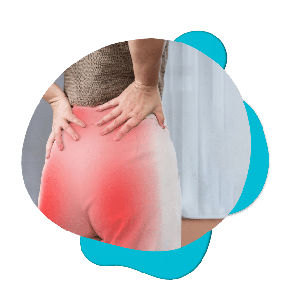 Sciatica Image 1